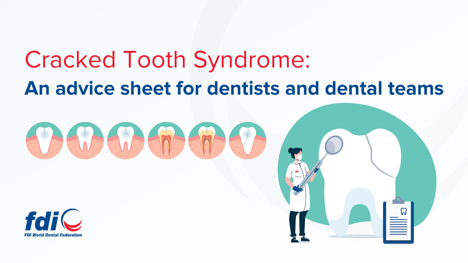 Cracked Tooth