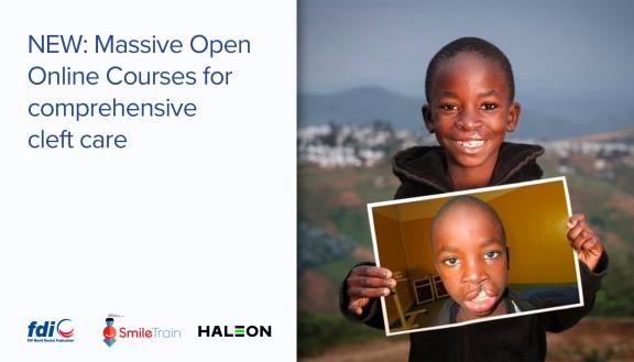 comprehensive cleft care massive open online courses oral health