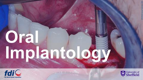Oral Implantology